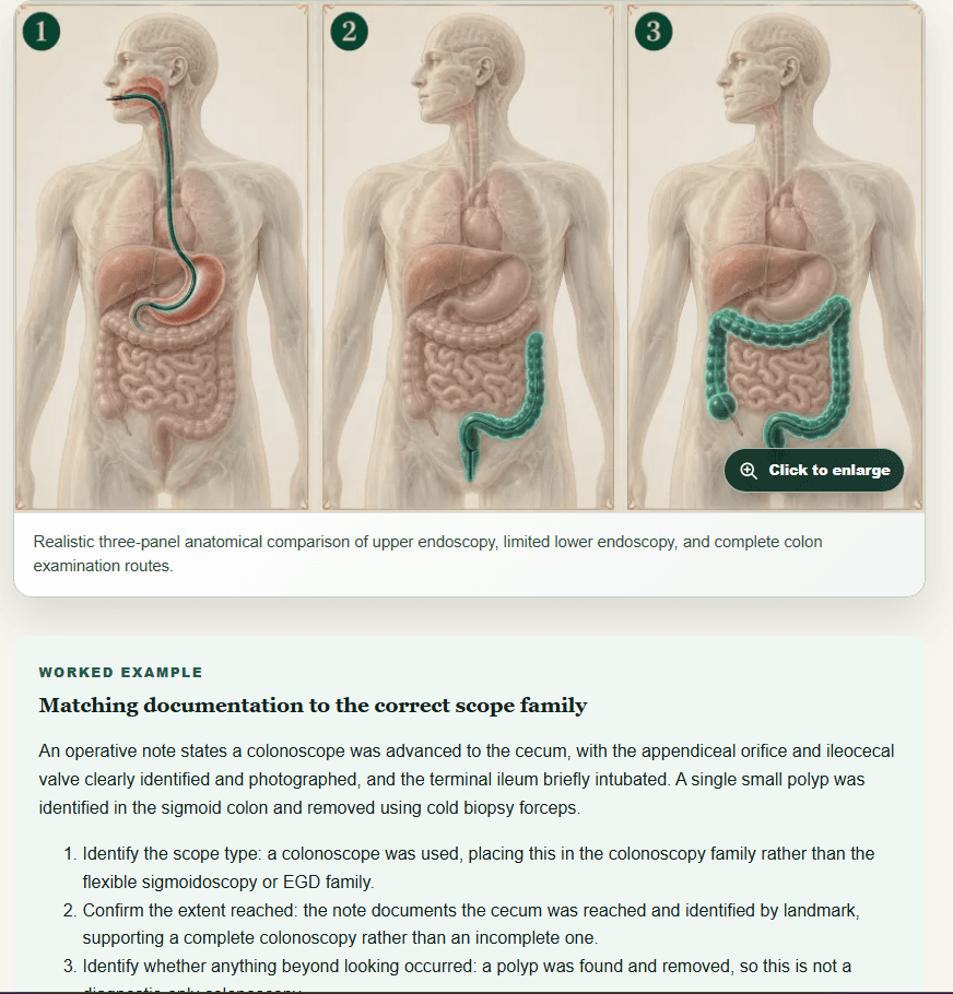 CPC digestive anatomy comparison showing upper endoscopy, limited lower endoscopy, and complete colon examination routes