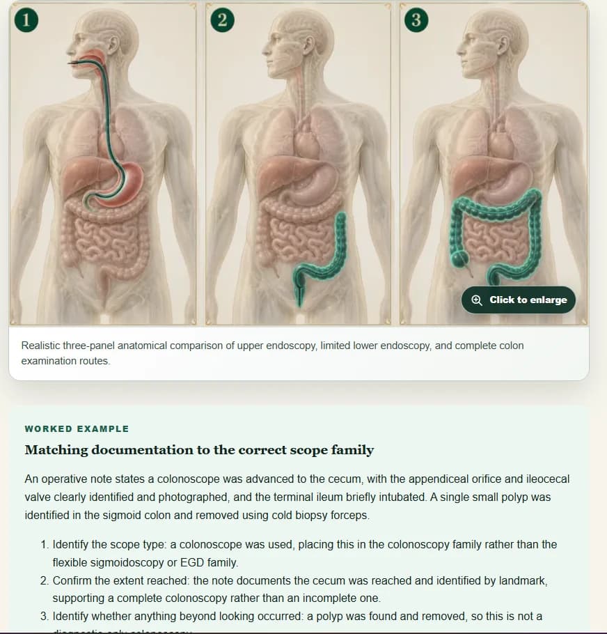 CPC digestive anatomy comparison showing upper endoscopy, limited lower endoscopy, and complete colon examination routes